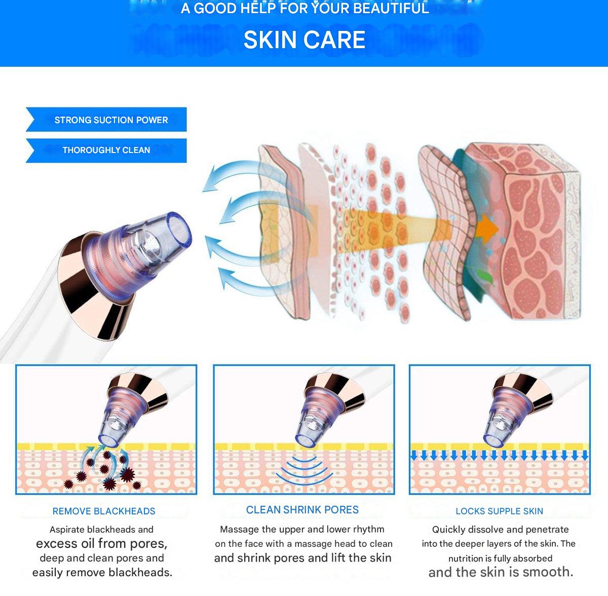 Carvallo PureGlow | Med 5 munstycken | Trådlös & smärtfri | Mot pormaskar & orenheter Carvallo