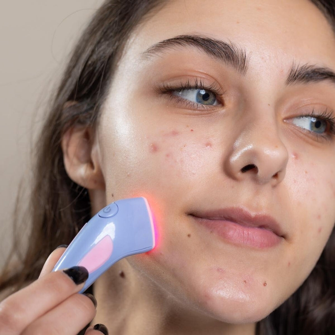 ClarityPro™ Acne Raderapparat-Hemnix-Hemnix