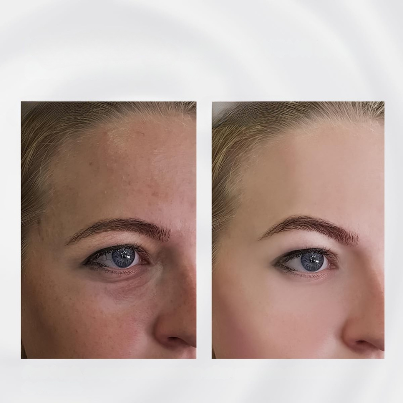 Lyft & Glow ansiktsskulpteringstav - Anti-aging massageapparat i rostfritt stål MILA Sverige