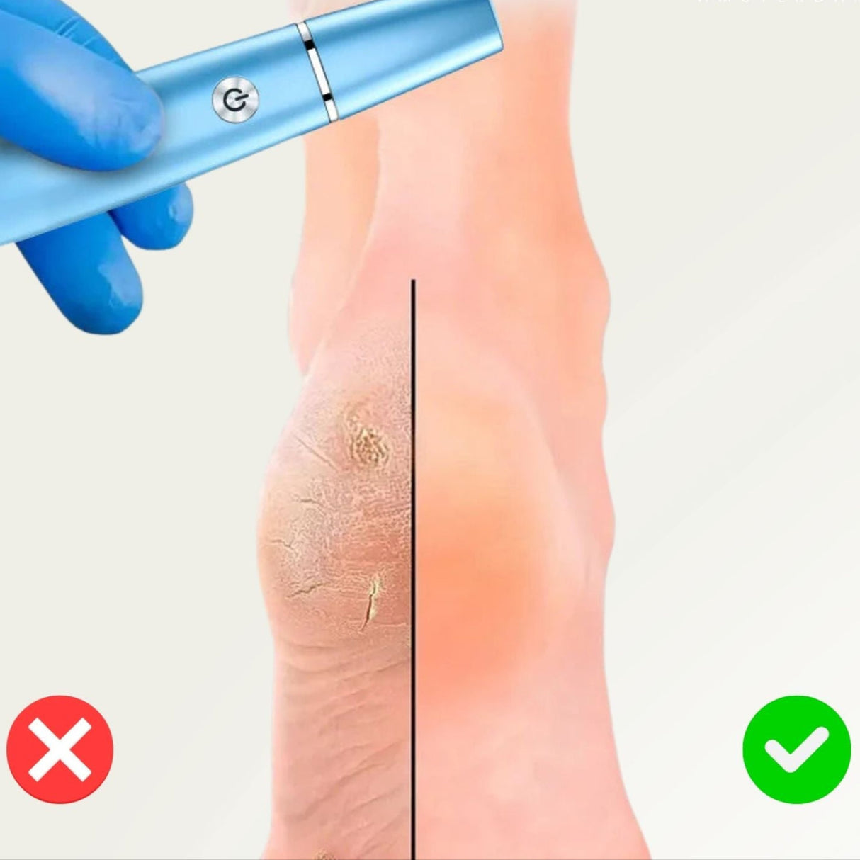 SilkyStep – Uppladdningsbar elektrisk fotfil | Vattentät förhårdnaderborttagare och pedikyrverktyg MILA Sverige