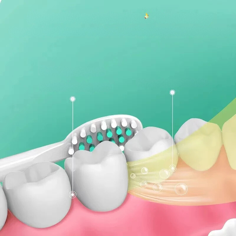 Carvallo Tandborste VibraDent Pure | Batteridriven | 4 Ersatzköpfe | IPX7 Vattentät | Skonsam ultraljudsrengöring Carvallo