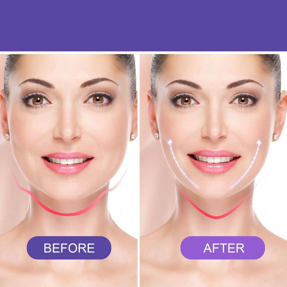 Carvallo – Osynlig omedelbar lyftning! Carvallo