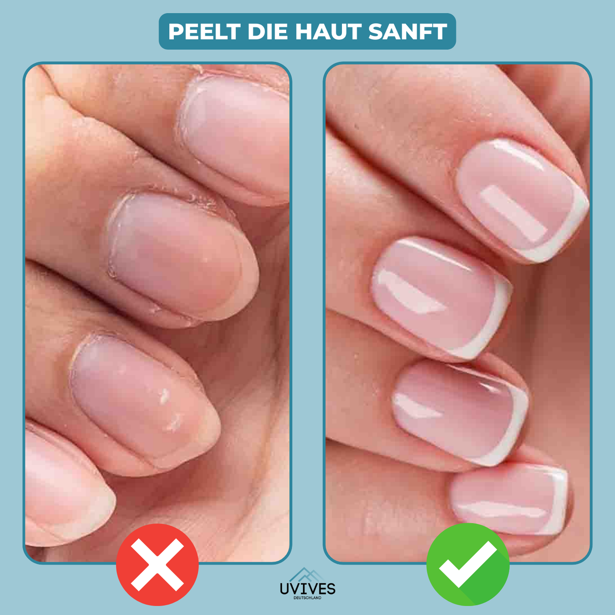 Carvallo | GlossBloom – Den 3-i-1 vårdpennan för strålande vackra naglar! Carvallo