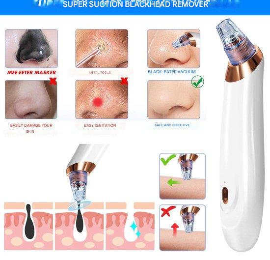 Carvallo PureGlow | Med 5 munstycken | Trådlös & smärtfri | Mot pormaskar & orenheter Carvallo