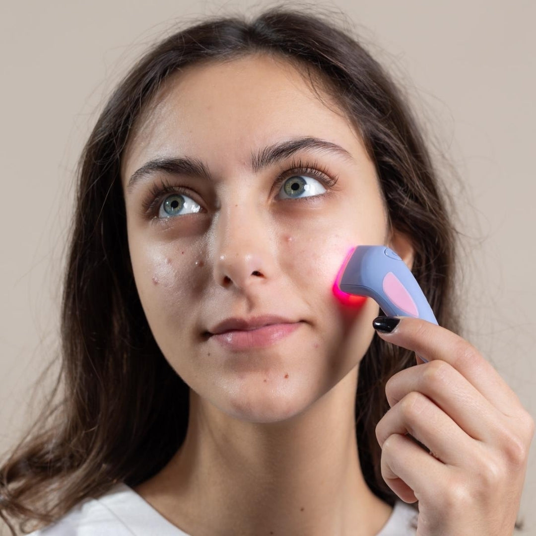 ClarityPro™ Acne Raderapparat-Hemnix-Hemnix