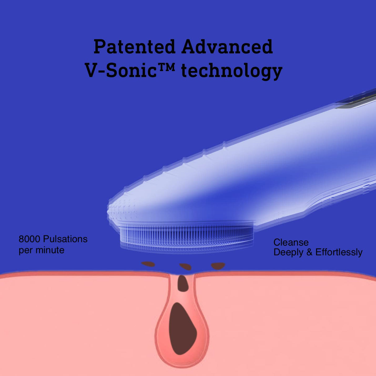 Carvallo GlowSoniq | Vattentät & Återuppladdningsbar | 3-i-1 Peeling, Rengöring & Massage Carvallo
