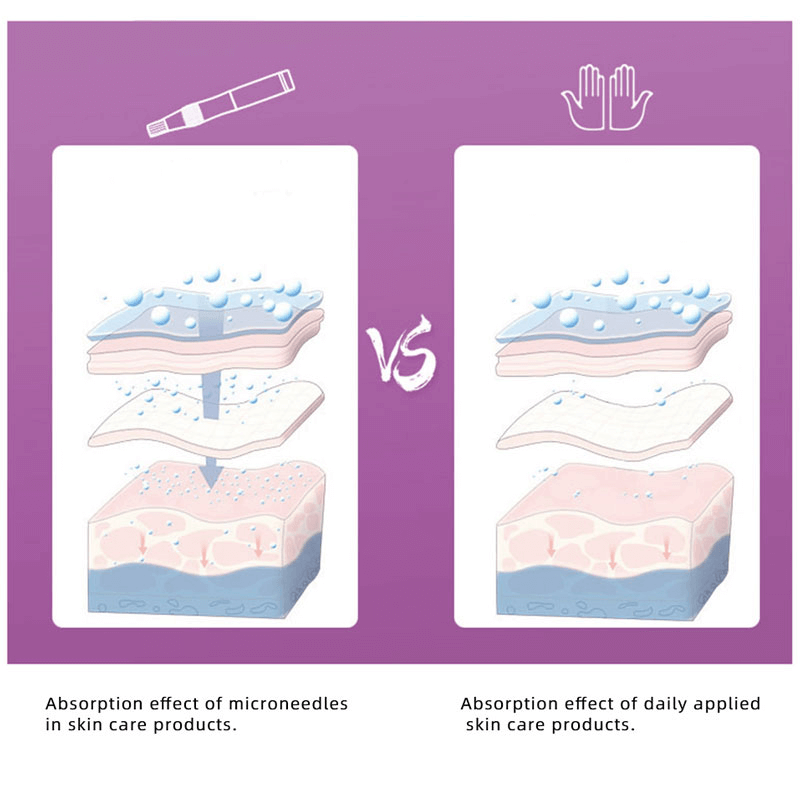 Professionell Derma Penna med Nanonålar-Personligt-BB-Hemnix