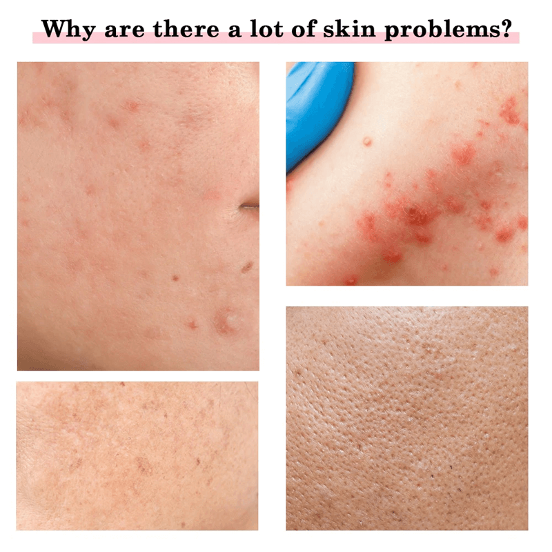 Multifunktionell Ansiktsvårds-massör Anti Aging-Personligt-BB-Hemnix