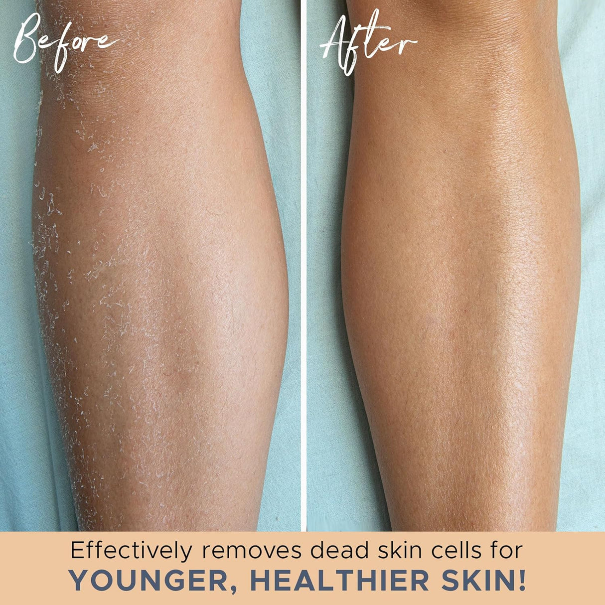 Exfolierande badvantar – 2-pack Carvallo