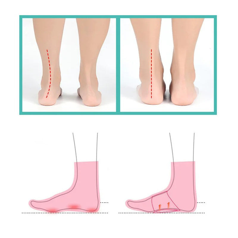 Ortopediska Fotvalvsstöd – Plattfot & Hälsporre (2 st)-Hemnix-Hemnix
