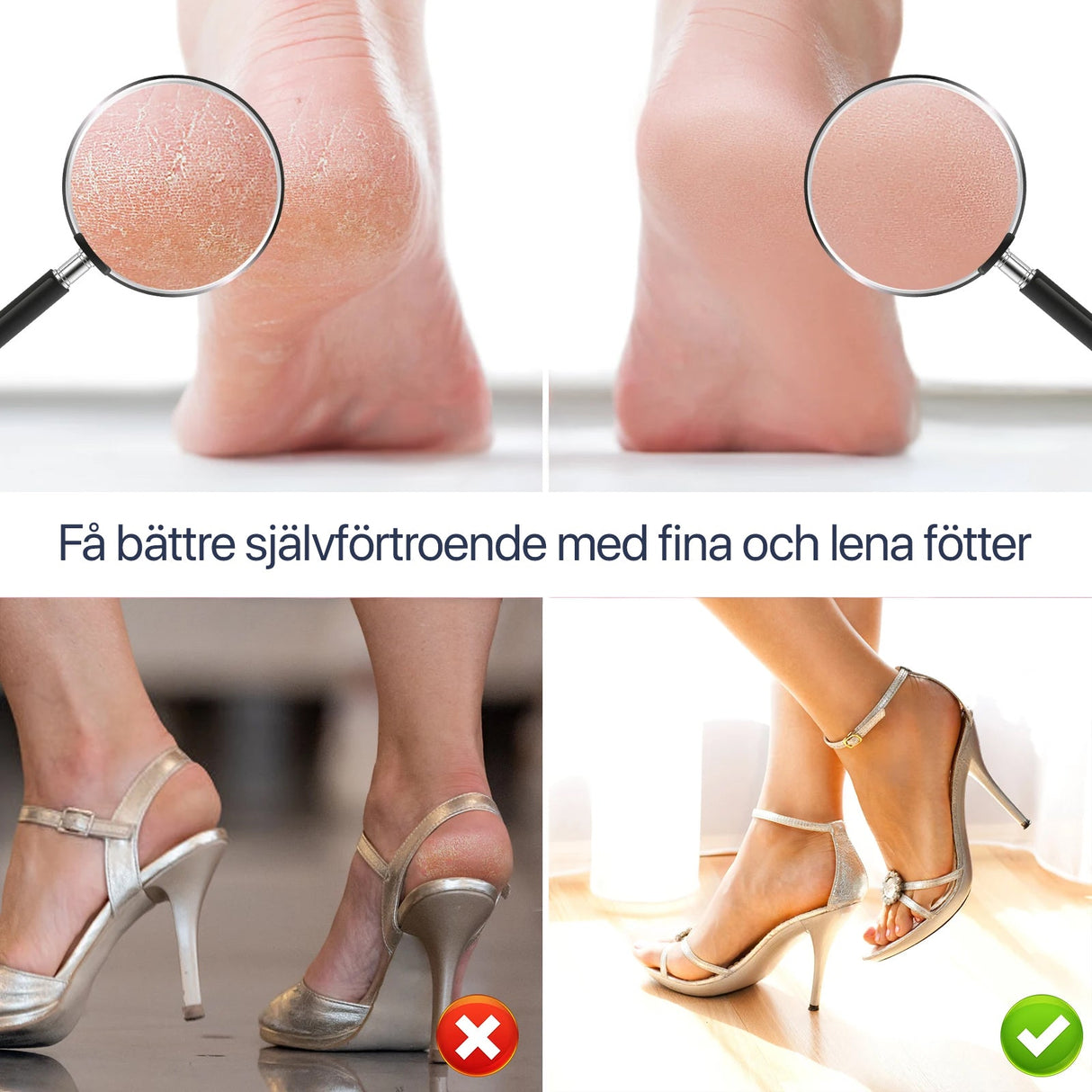 Elektrisk Fotfil - få lena och fina fötter-Hemnix-Hemnix