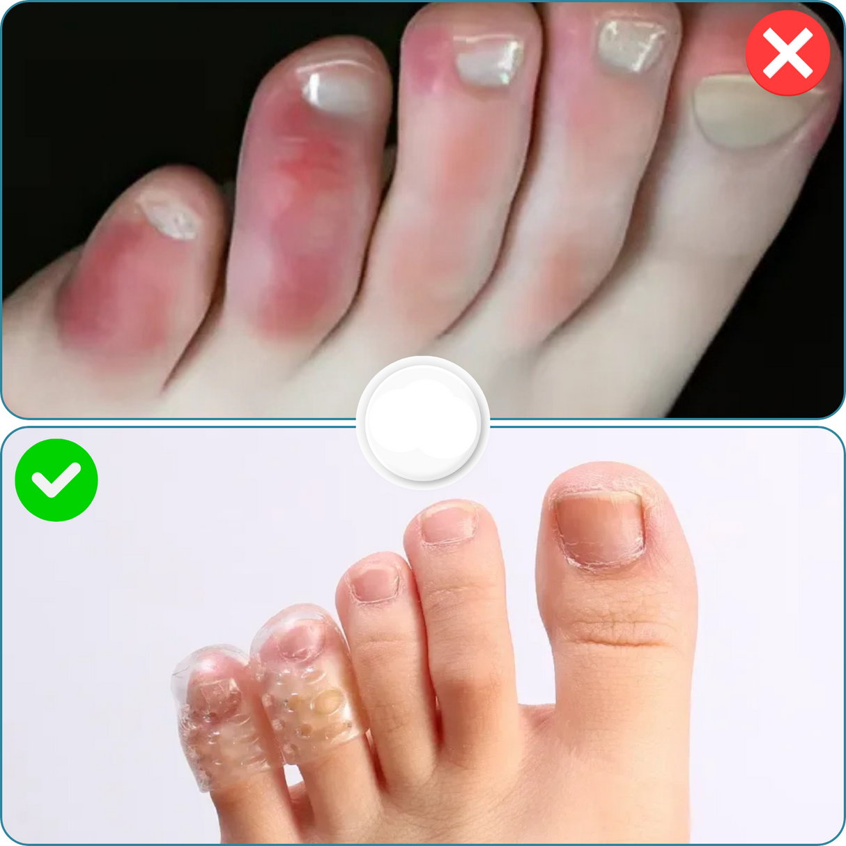 Carvallo | SafeWalk – Gå mjukt, må bättre Carvallo