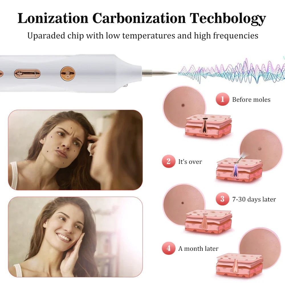 Plasmapenna Hudfliks Borttagare-Personligt-BB-Hemnix