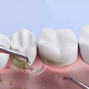 Royaleva Ultraljudsskalare för Hemmabruk Carvallo