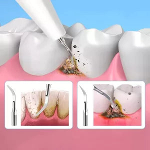 Royaleva Ultraljudsskalare för Hemmabruk Carvallo