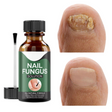 Avancerat svampdödande nagelserum – Snabb lindring av tånagel- och fingernagelinfektioner MILA Sverige