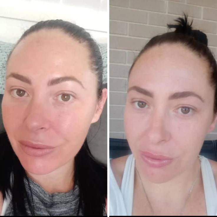 LED Ansiktsmask Ljusterapi Hudvårdsapparat Carvallo