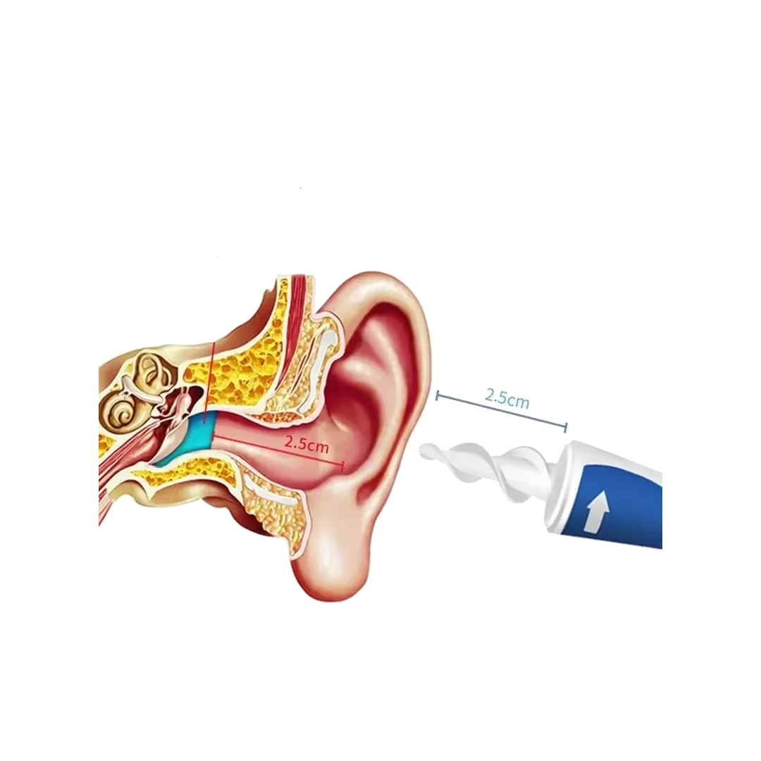 Öronrensare med mjuka silikonhuvuden-Hemnix-Hemnix