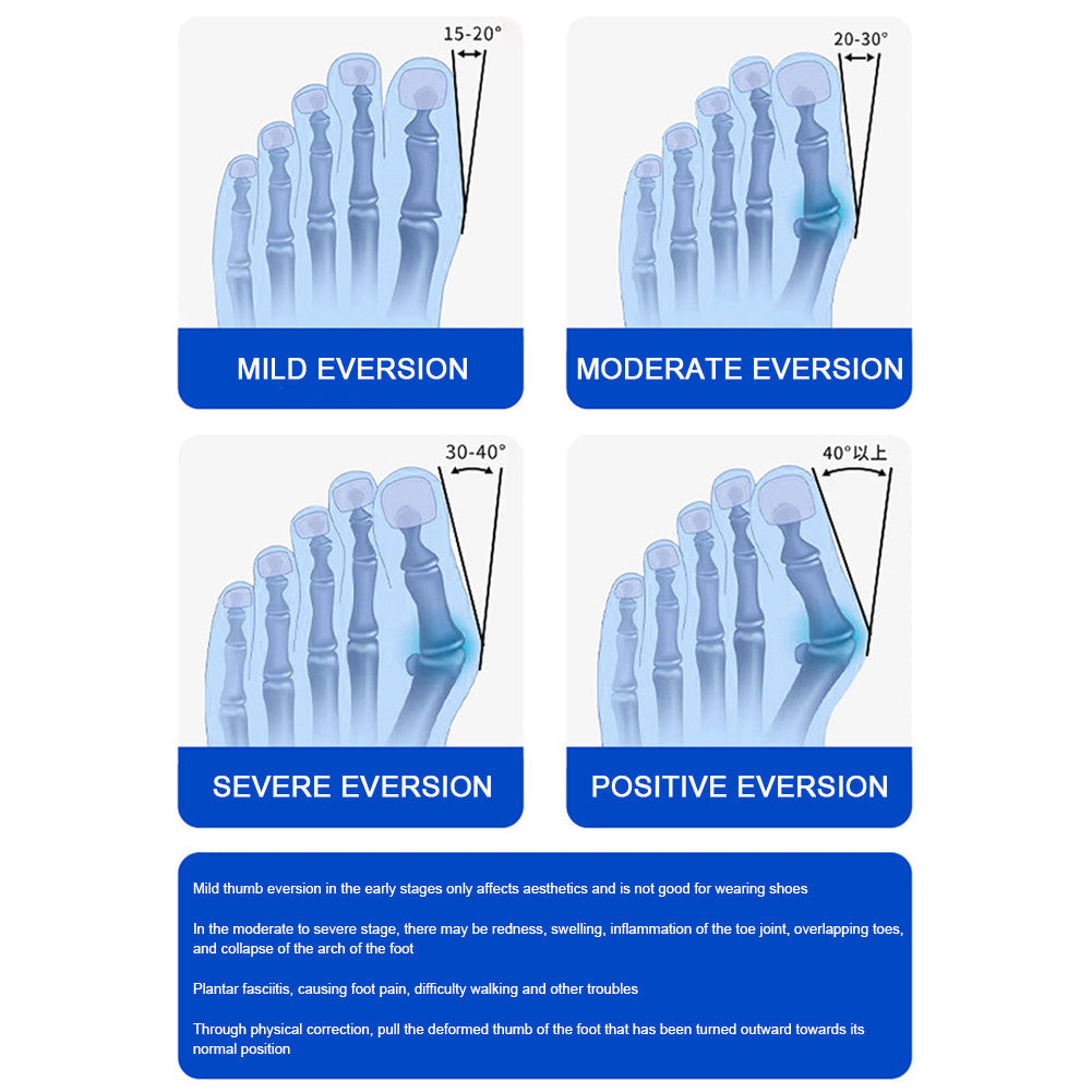 Carvallo – Smärtfri gå utan operation Carvallo