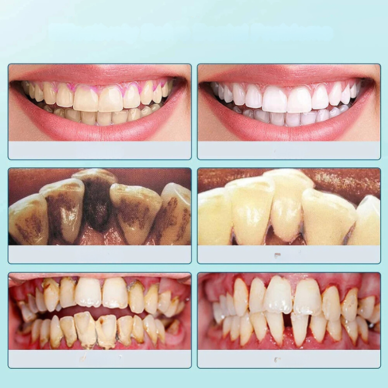 Carvallo tandrenser Plaktrino | tandsten- & belæg fjerner | blid & effektiv | kompakt 10 cm Carvallo