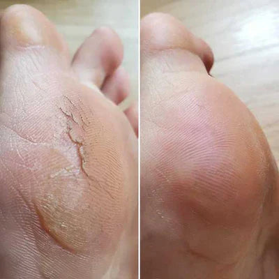 Bliss Silk Pro 2 – Mjuka fötter utan dyra salongsbesök-VaruZ-Hemnix