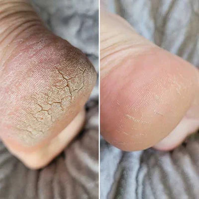 Bliss Silk Pro 2 – Mjuka fötter utan dyra salongsbesök-VaruZ-Hemnix