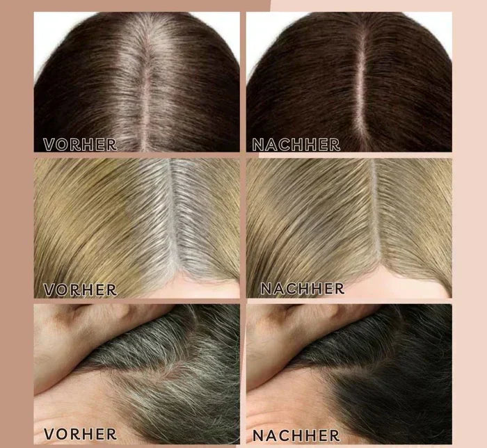 Carvallo – Perfekta hårlinjer när som helst Carvallo