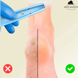 SilkaFeet™ – Lätta släta och välvårdade fötter Carvallo