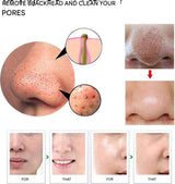 Carvallo PureGlow | Med 5 munstycken | Trådlös & smärtfri | Mot pormaskar & orenheter Carvallo