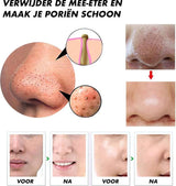 Elektrisk pormaskborttagare Carvallo