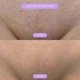 Hårborttagningsapparat för mjuk len hud Carvallo