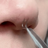 Luxora Svartprick Tång - Anti Svartprick Kit Set 3 Pcs Carvallo