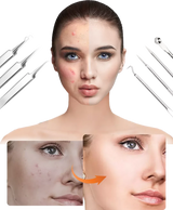 Carvallo Set PureSkinX | Precise & Hygienic | Stainless Steel Tools for Clear Skin Carvallo