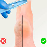 SilkyStep – Uppladdningsbar elektrisk fotfil | Vattentät förhårdnaderborttagare och pedikyrverktyg MILA Sverige