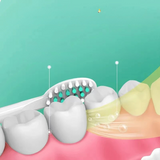 Carvallo Tandborste VibraDent Pure | Batteridriven | 4 Ersatzköpfe | IPX7 Vattentät | Skonsam ultraljudsrengöring Carvallo