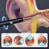 Öronvaxborttagning Carvallo