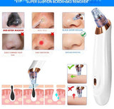 Carvallo PureGlow | Med 5 munstycken | Trådlös & smärtfri | Mot pormaskar & orenheter Carvallo