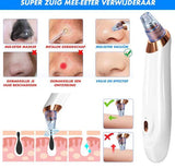 Elektrisk pormaskborttagare Carvallo