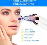 Carvallo PureGlow | Med 5 munstycken | Trådlös & smärtfri | Mot pormaskar & orenheter Carvallo