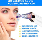 Elektrisk pormaskborttagare Carvallo