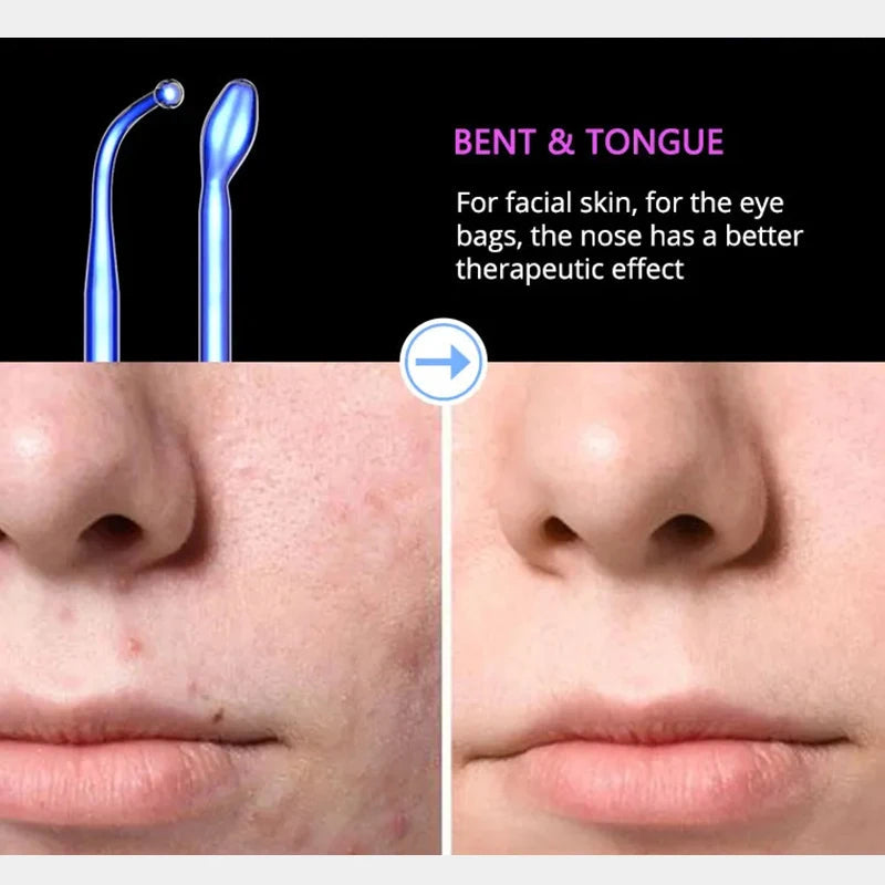 Professionell Högfrekvens Ansikts- & Hårterapi Penna Carvallo