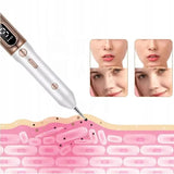 Plasma Pen För Att Ta Bort Hudflikar, Födelsemärken Och Varnande Carvallo