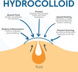 PoreClean - Akneplåster med Hydrokolloid för Frisk Hud på En Natt-Akne Plåster-HealyNova-Hemnix