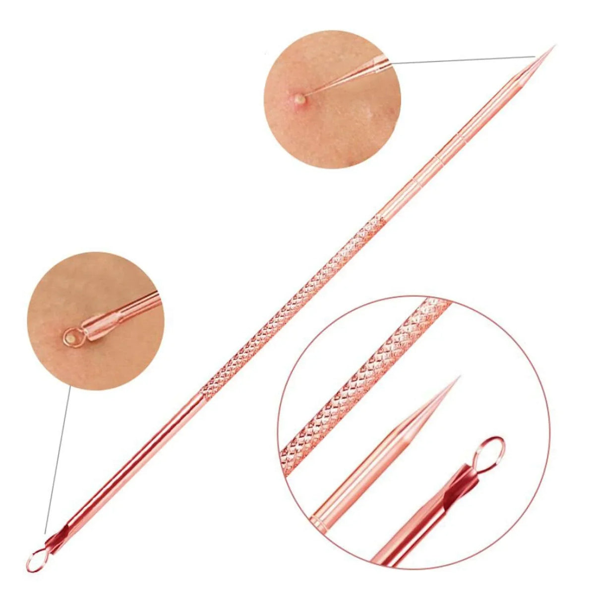 Pormask- och finnarborttagningsset Carvallo