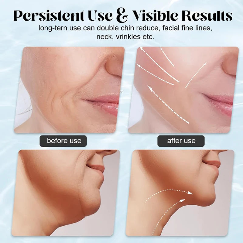 LED Ansikte & Nacke Lyftande Massager Carvallo