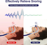 Bärbar mikro-CPAP-apparat - Resevänlig lösning mot snarkning och lindring av sömnapné MILA Sverige