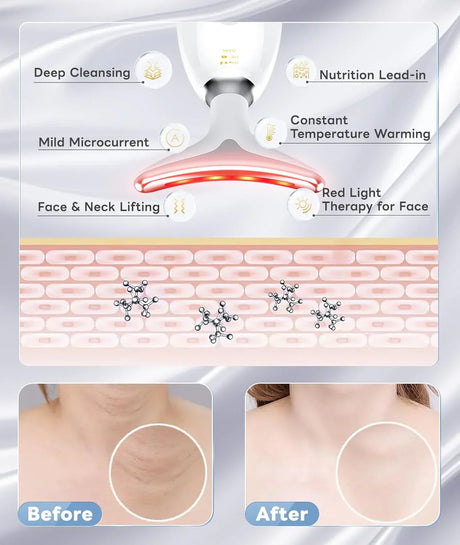 RadiantGlow 7-Färger LED-ansiktsmask Carvallo