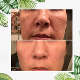 Ansiktsmaskpinne för fet hud detox Carvallo
