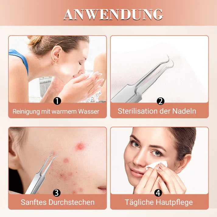 Carvallo Set PureSkinX | Precise & Hygienic | Stainless Steel Tools for Clear Skin Carvallo