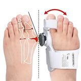 Uppgraderad Tå Bunion Korrigerare – Justerbar Ortopedisk Splint för Smärtlindring & Alignment Carvallo